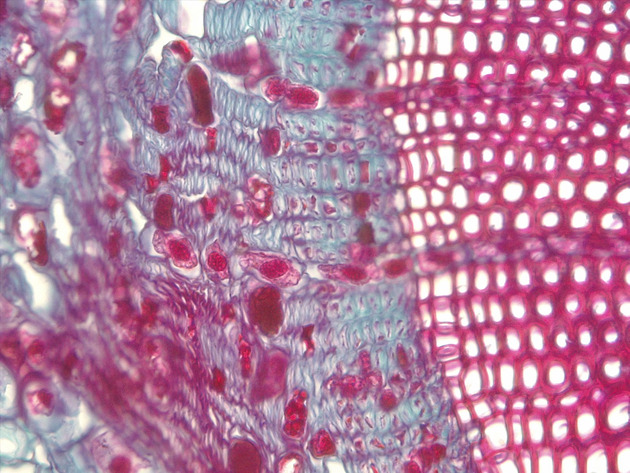 Pine Stem CS Slides - Pine Stem CS 02 400X